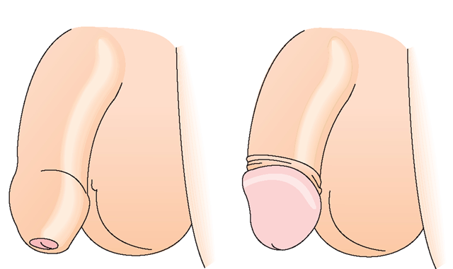 bao-quy-dau-la-gi