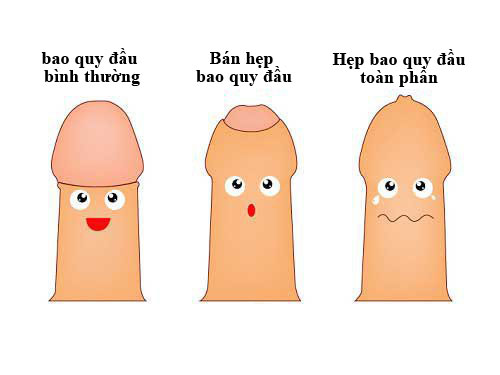 Bán hẹp bao quy đầu là gì, có sao không, chữa thế nào?