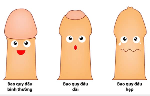 các bệnh bao quy đầu