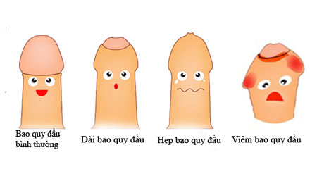 bệnh về bao quy đầu