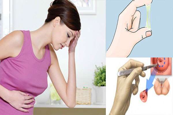 bị viêm lộ tuyến cổ tử cung có mang thai được không