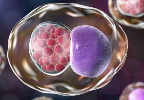 Chlamydia tracomatis