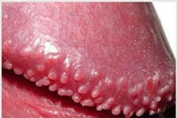 chuỗi hạt ngọc dương vật