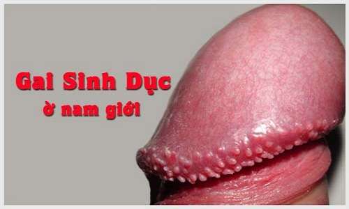gai-sinh-duc-nam