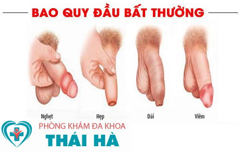 10+ bệnh nam khoa thường gặp và triệu chứng nhận biết