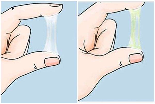 khí hư bất thường
