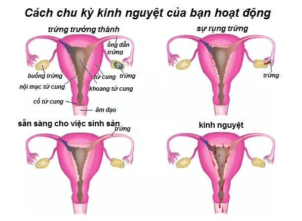 Không ra kinh nguyệt là bị bệnh gì? Nguyên nhân và giải pháp hữu ích