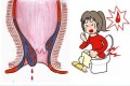 Đi đại tiện ra máu khám ở đâu