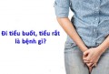 Đi tiểu buốt, tiểu rắt và cách chữa trị tại nhà hiệu quả
