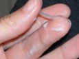 Khí hư màu trắng đục như sữa