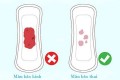 Máu báo thai là gì? Phân biệt máu báo thai với máu báo kinh nguyệt