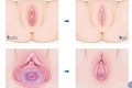 Các cách thu nhỏ vùng kín sau sinh