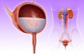 Viêm đường tiết niệu và những thông tin cần biết