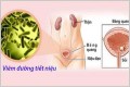 Cách điều trị bệnh viêm đường tiết niệu hiệu quả