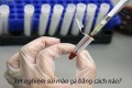 Xét nghiệm sùi mào gà bằng cách nào? Sau bao lâu có kết quả?