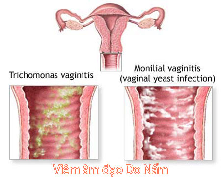 viem nam am dao