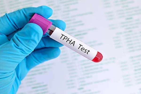 xet-nghiem-TPHA